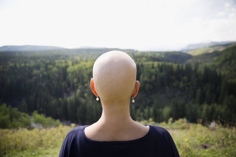 Female cancer survivor with shaved head looking at remote rural view